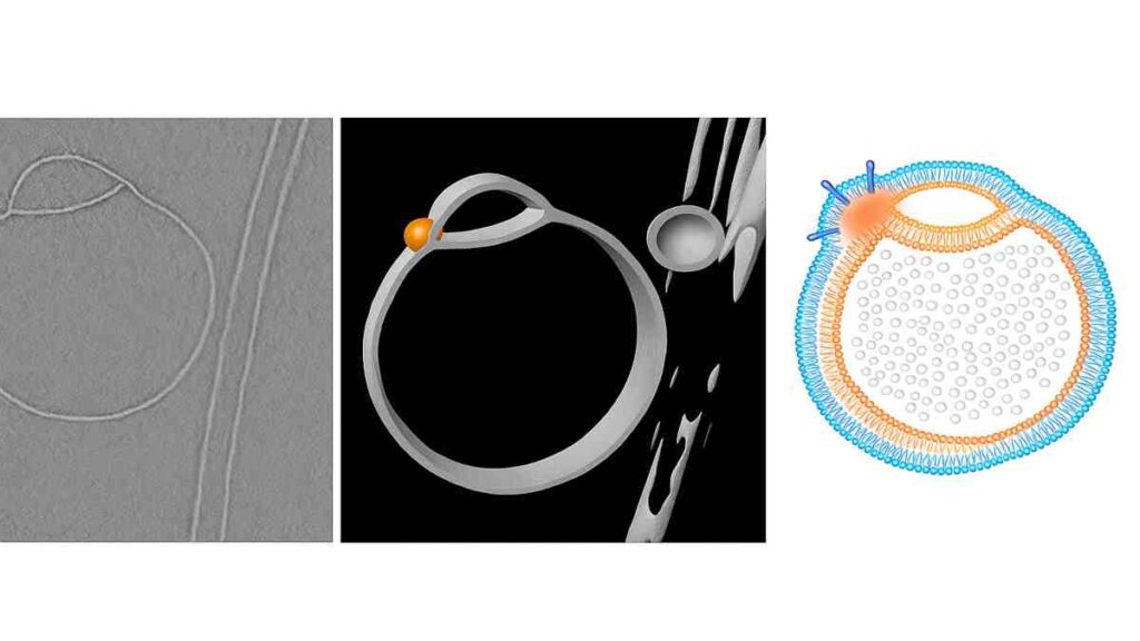 Microscopic triptych image of vesicle structures in human cell organelle discovery"
